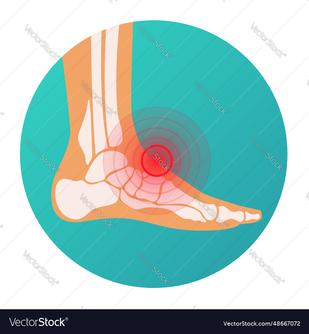 Red circle pain localization in human foot Vector Image