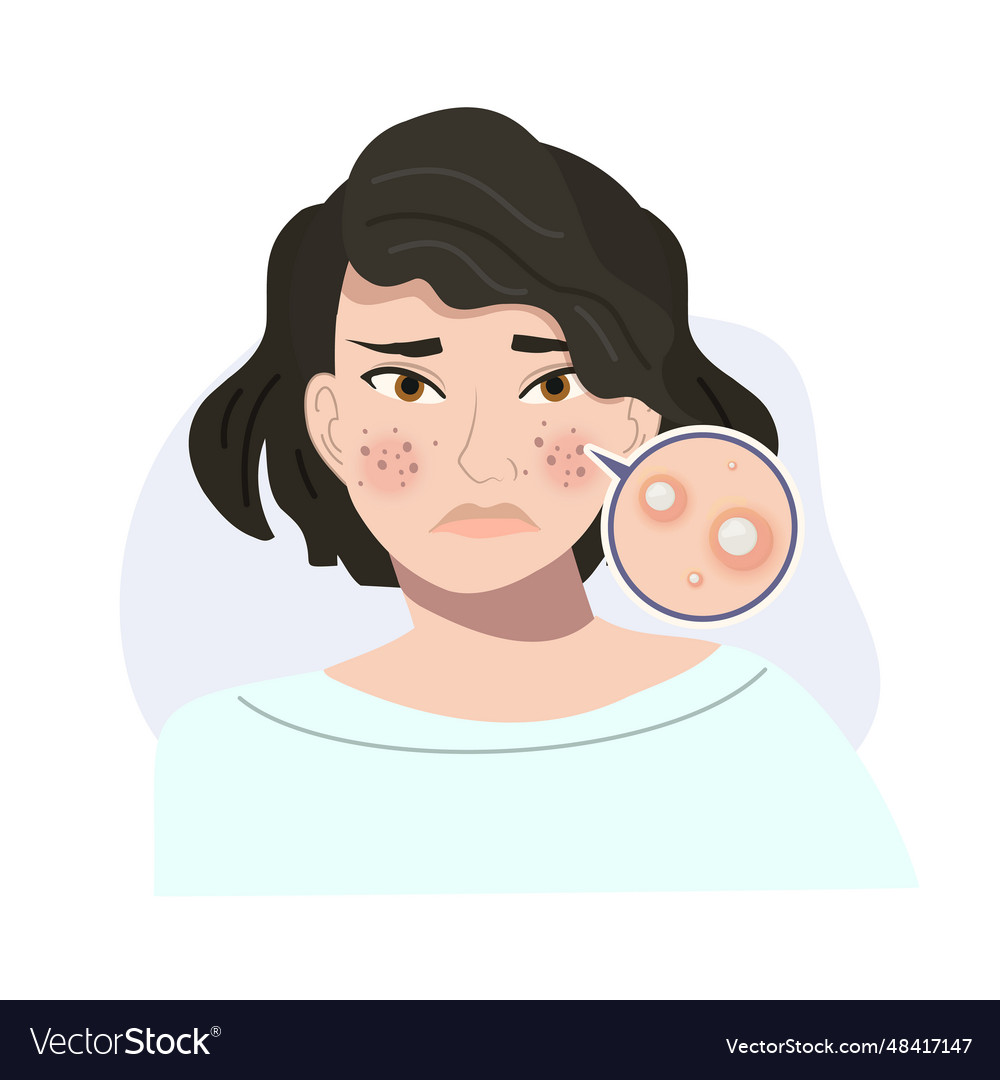 Portrait of stressed female with troubled skin Vector Image