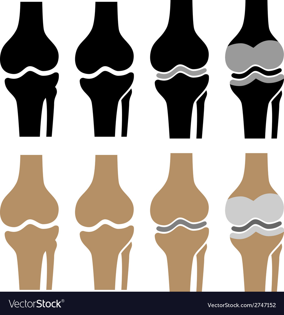 Human knee joint symbols Royalty Free Vector Image