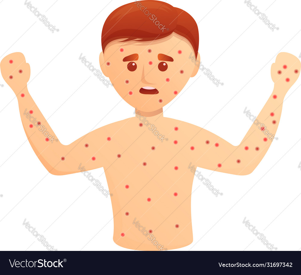 Rash Cartoon - Scabies Human Skin Stock Photos & Scabies Human Skin ...