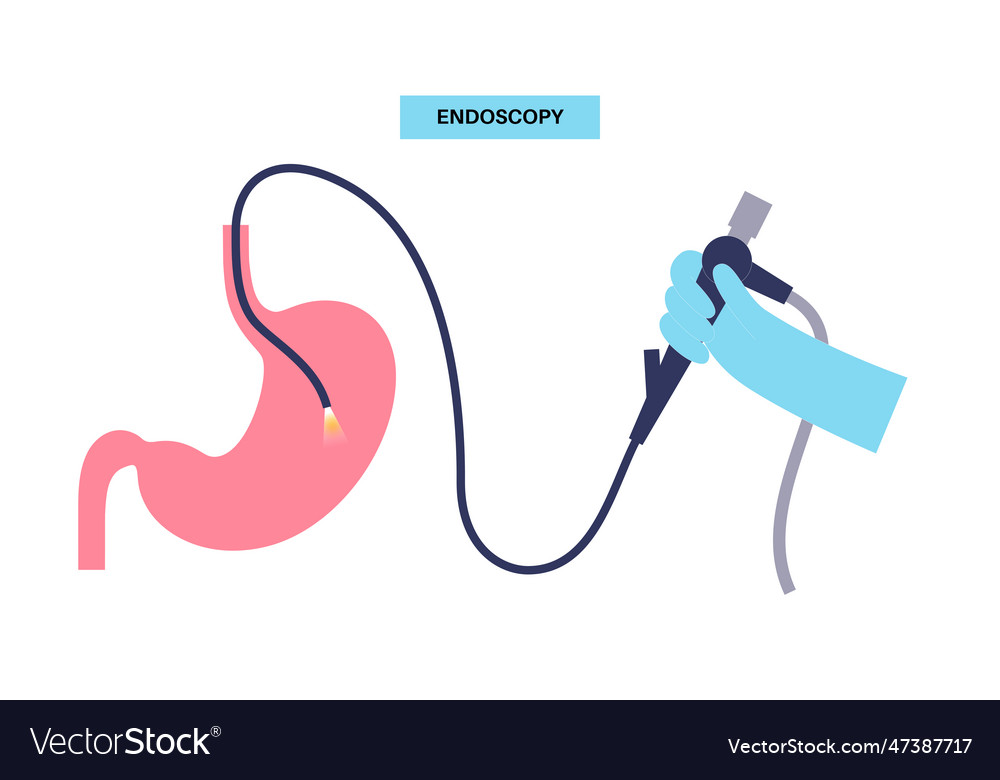 Gastroscopy Endoscopy Procedure Royalty Free Vector Image