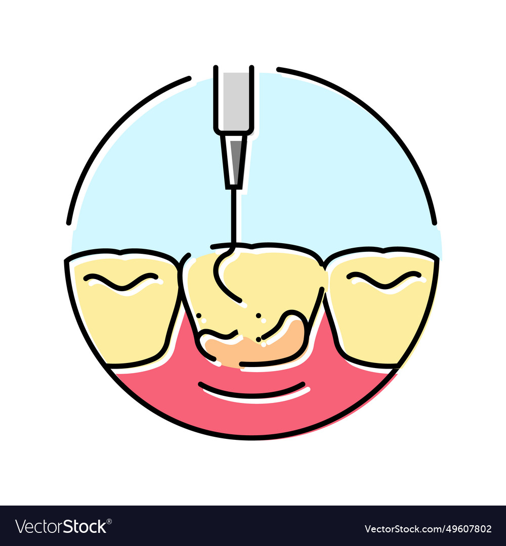 Scaling dental procedure color icon Royalty Free Vector