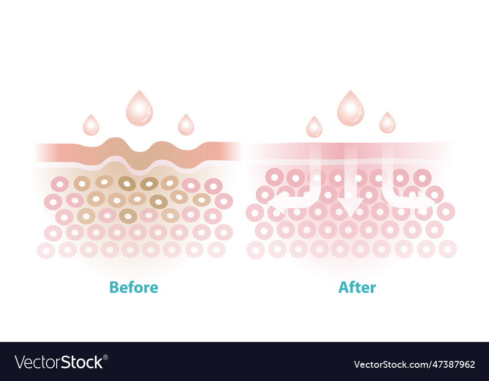 Before and after skincare reduce wrinkles Vector Image