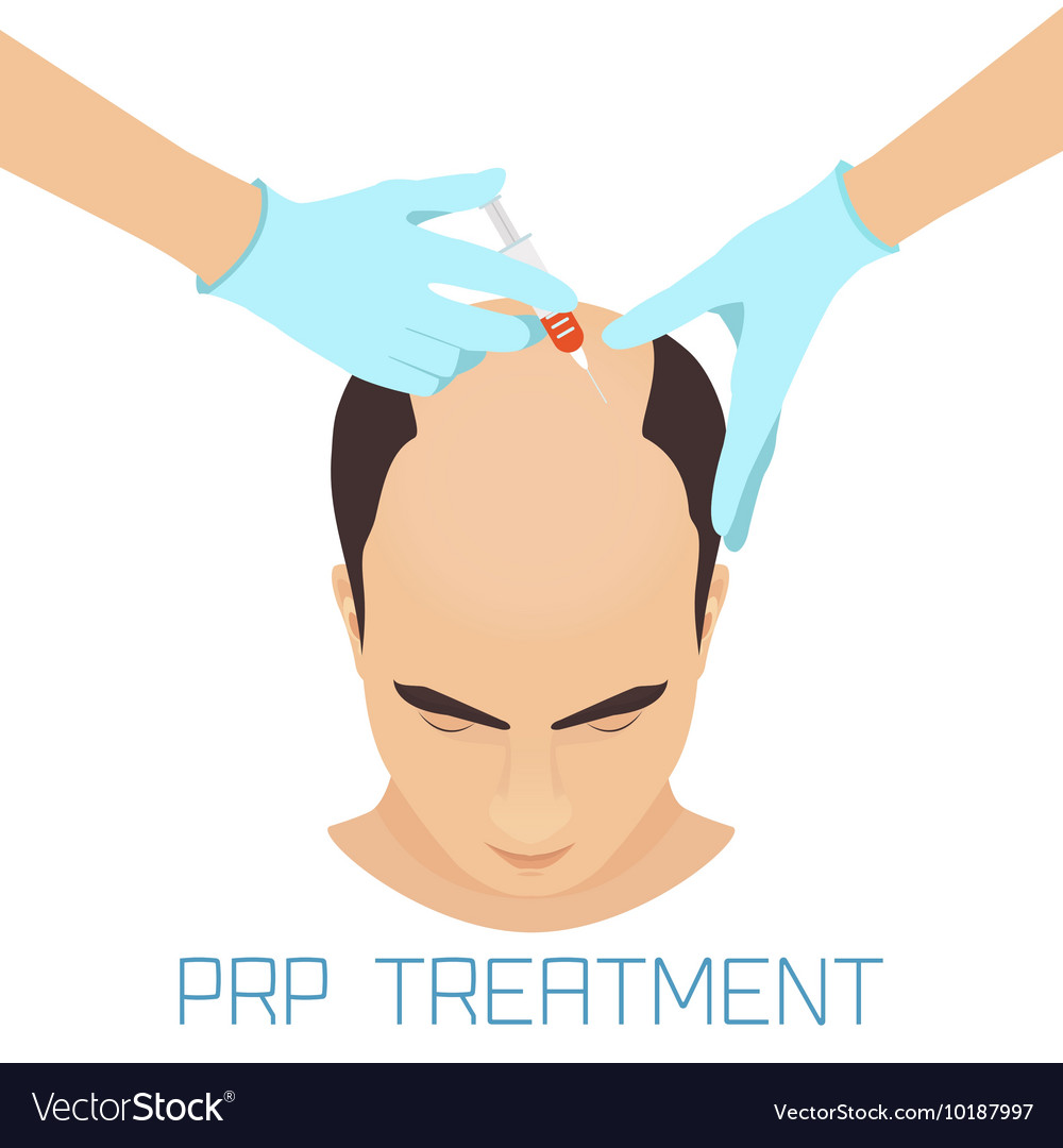 Prp treatment for men