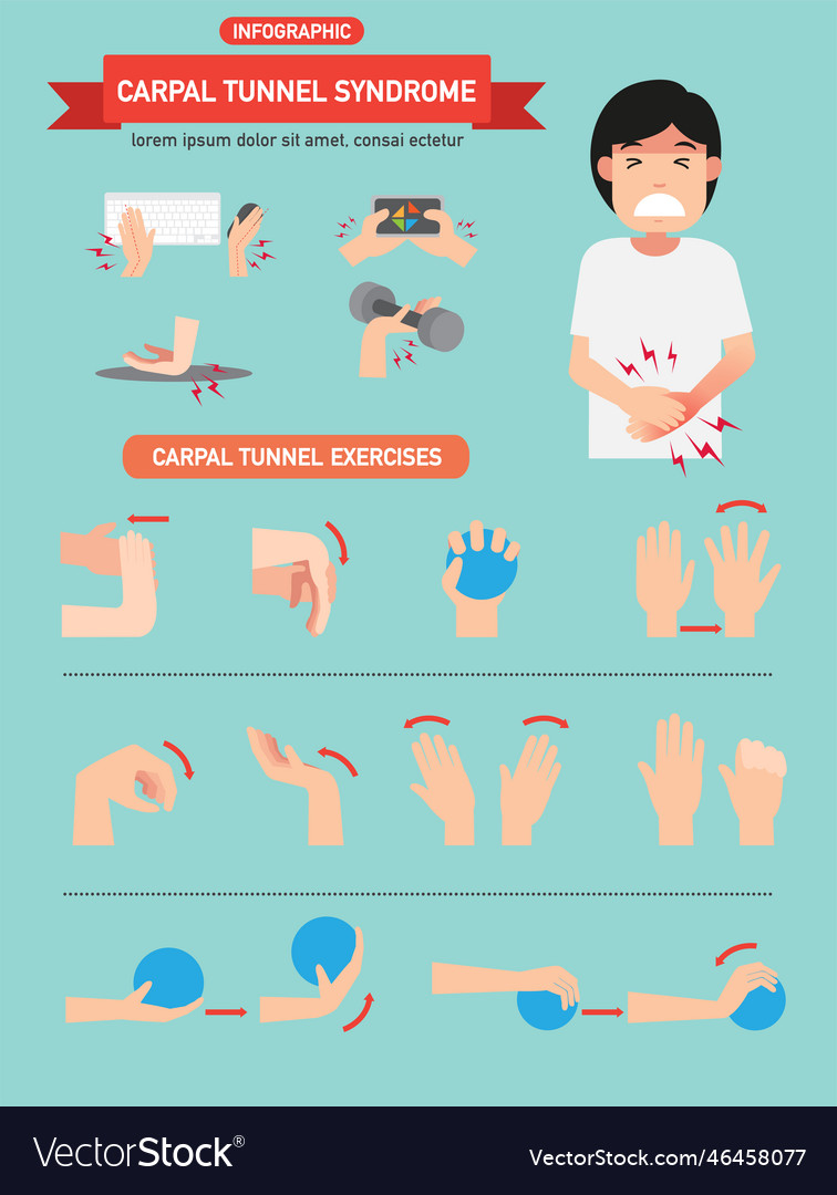 Carpal tunnel syndrome infographic Royalty Free Vector Image