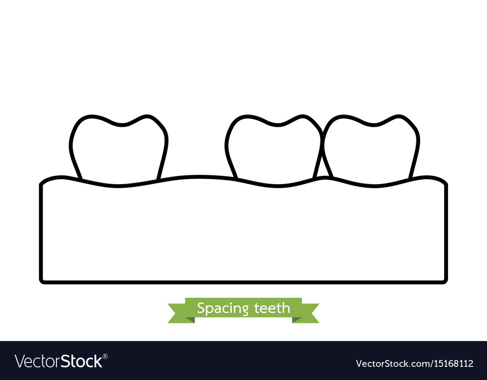 Spacing teeth diastema - cartoon outline style