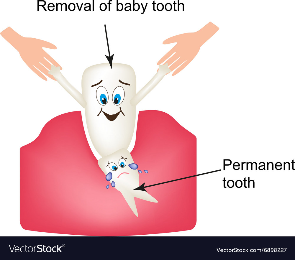 Removing baby teeth infographics Royalty Free Vector Image