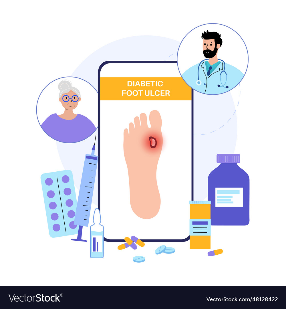 Diabetic foot ulcers Royalty Free Vector Image