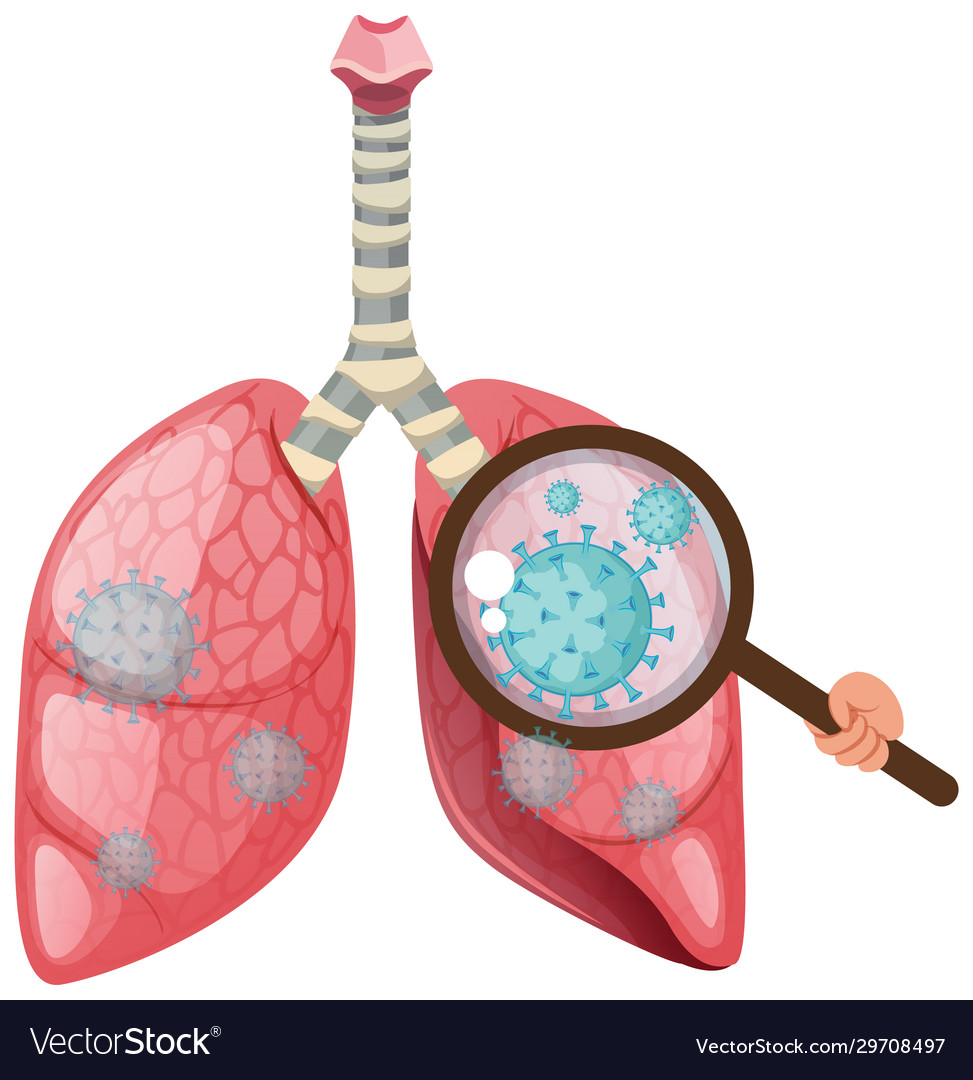 Human lungs with coronavirus cell spreading on Vector Image