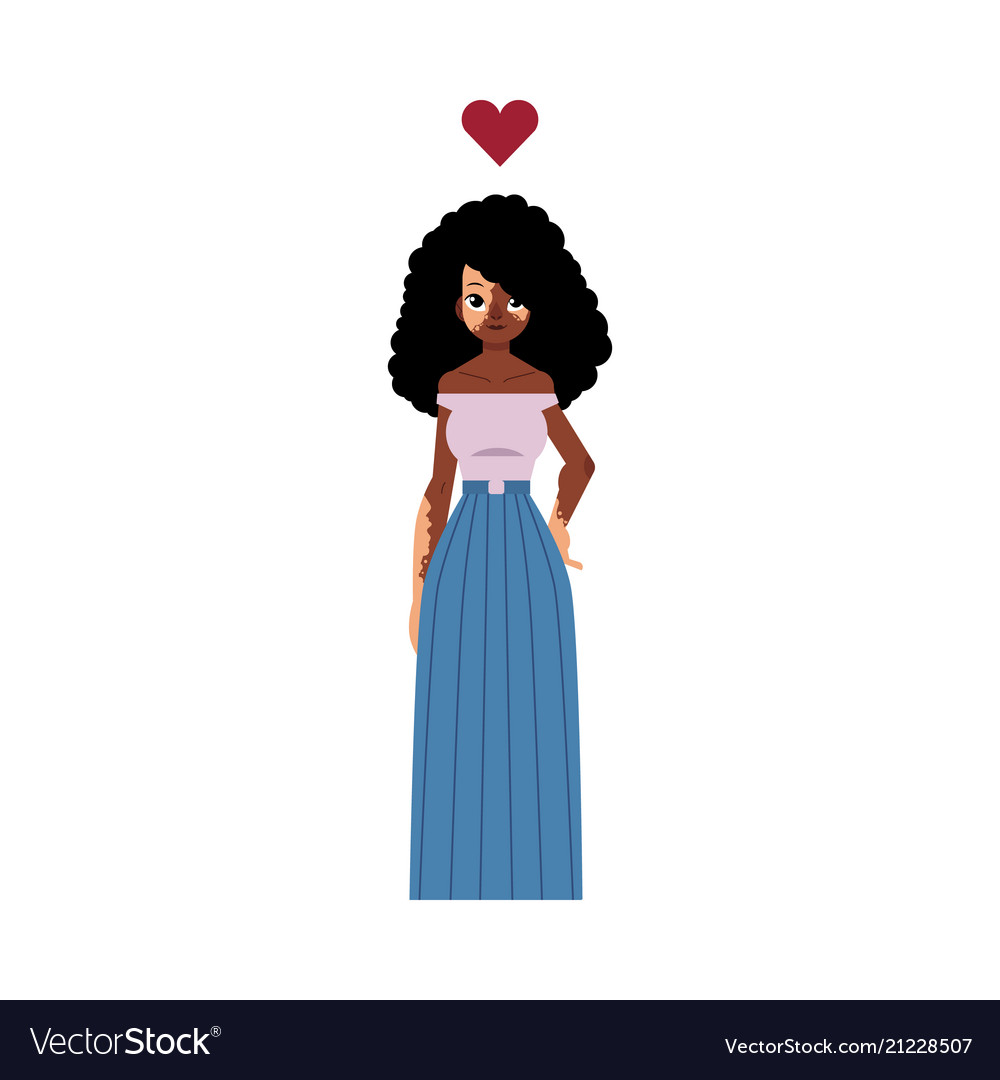 Vitiligo Affected African Girl With White Patches Vector Image