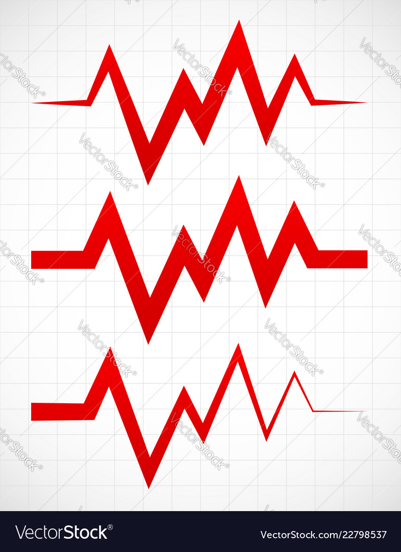 Irregular pulsating or ecg lines over gridded