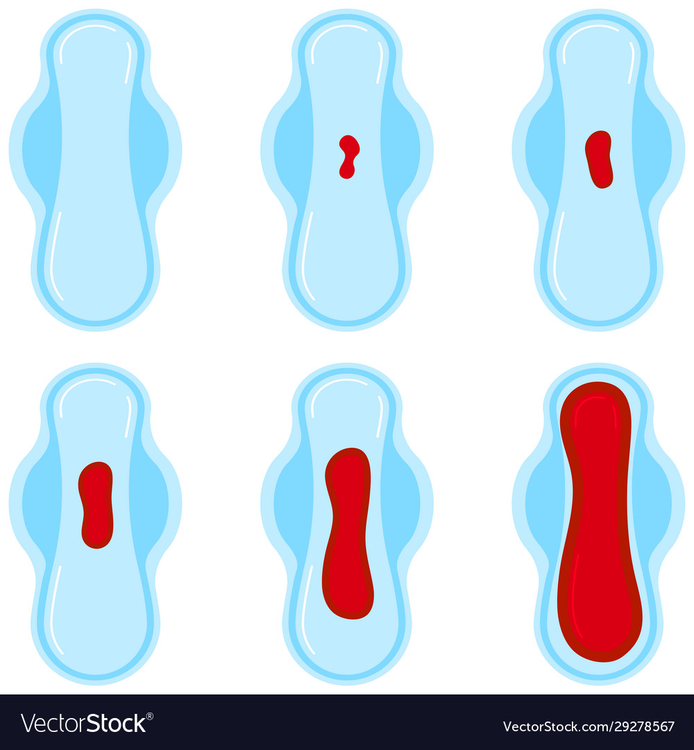 Blood Loss Flow Chart