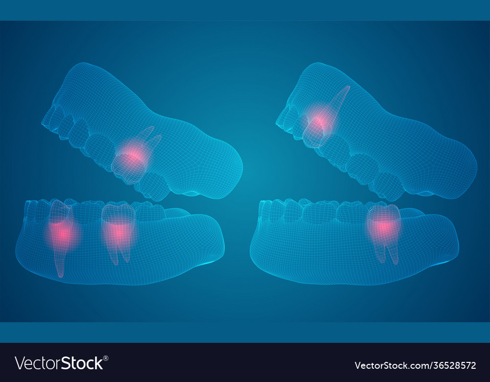 Mensch Kiefer 3d Layout Medizin und Gesundheit Schmerz Zähne