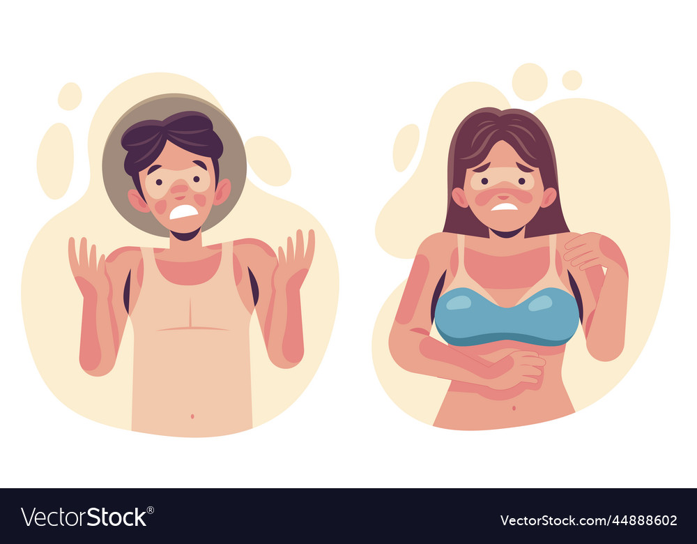 Flat Design People With Sunburn Royalty Free Vector Image