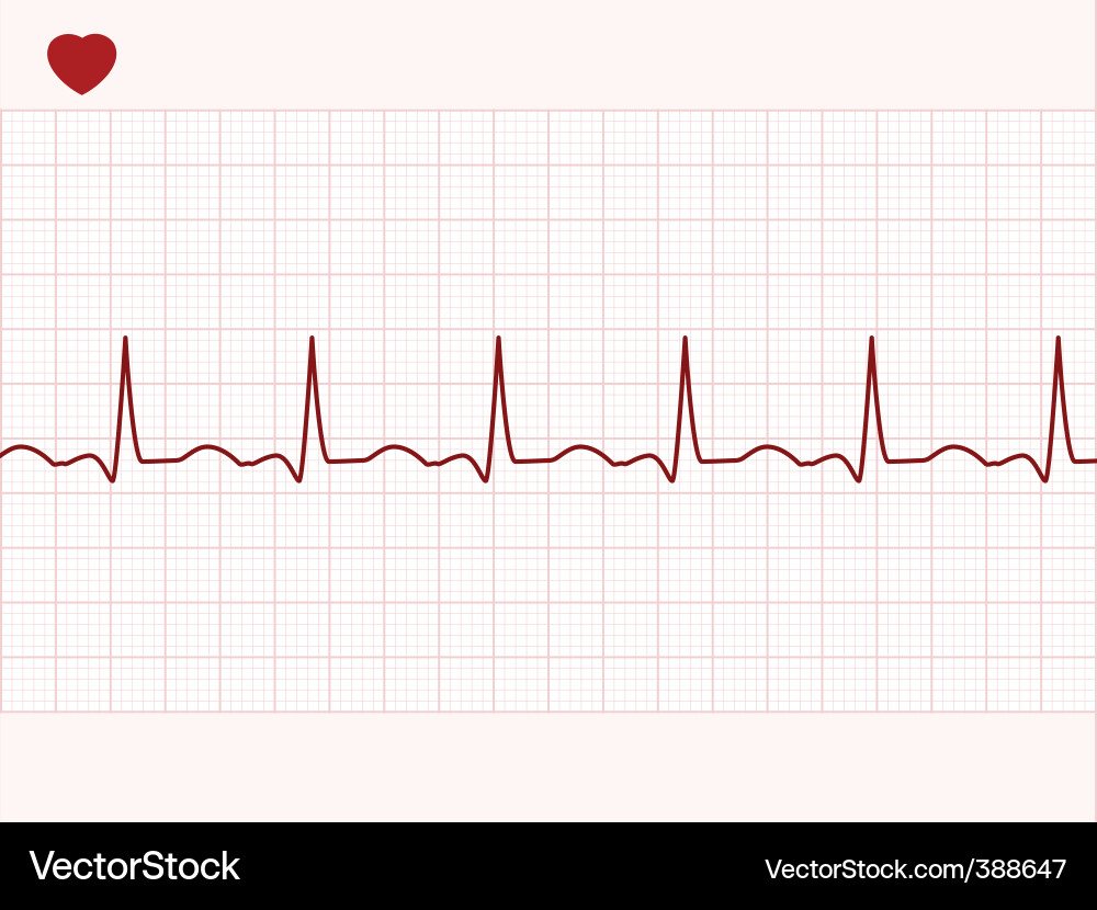 Electronic cardiogram Royalty Free Vector Image