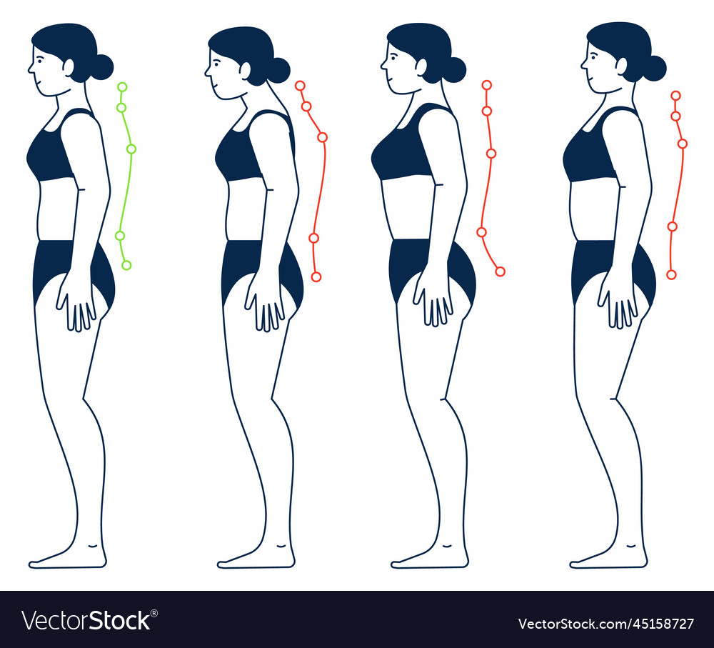 Woman back correction side view wrong and right Vector Image