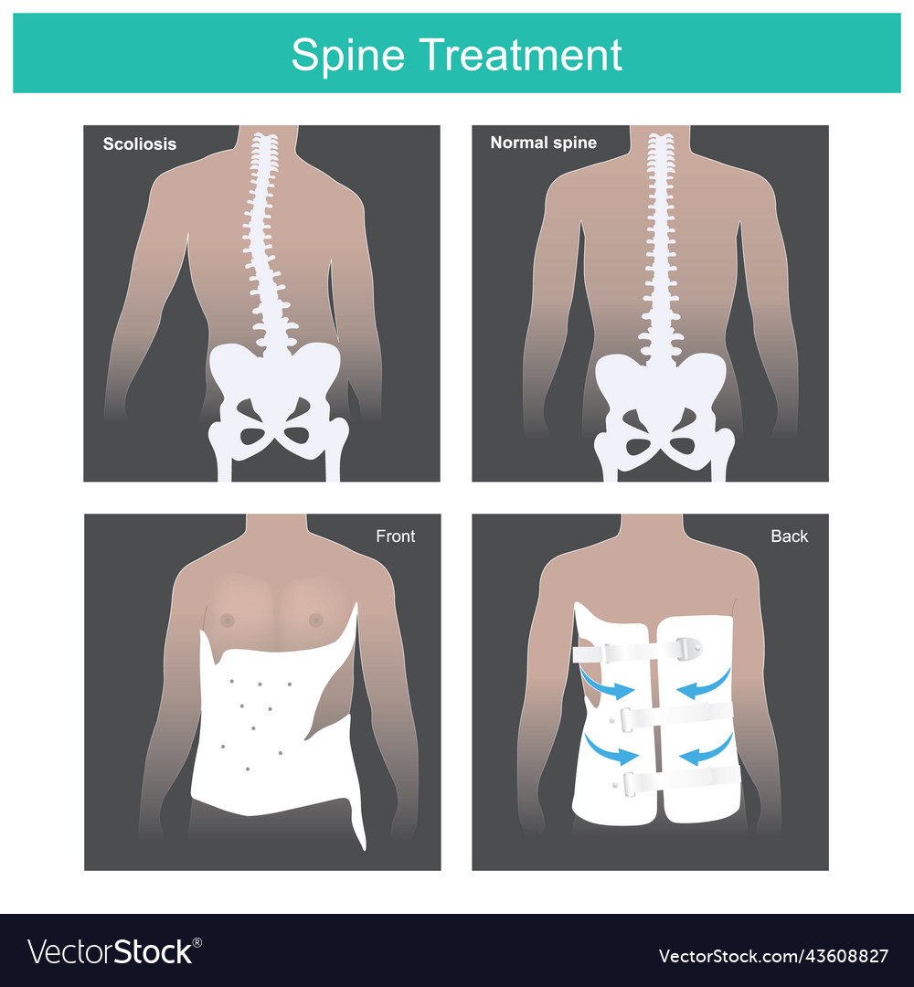 Spine treatment he has abnormal and after