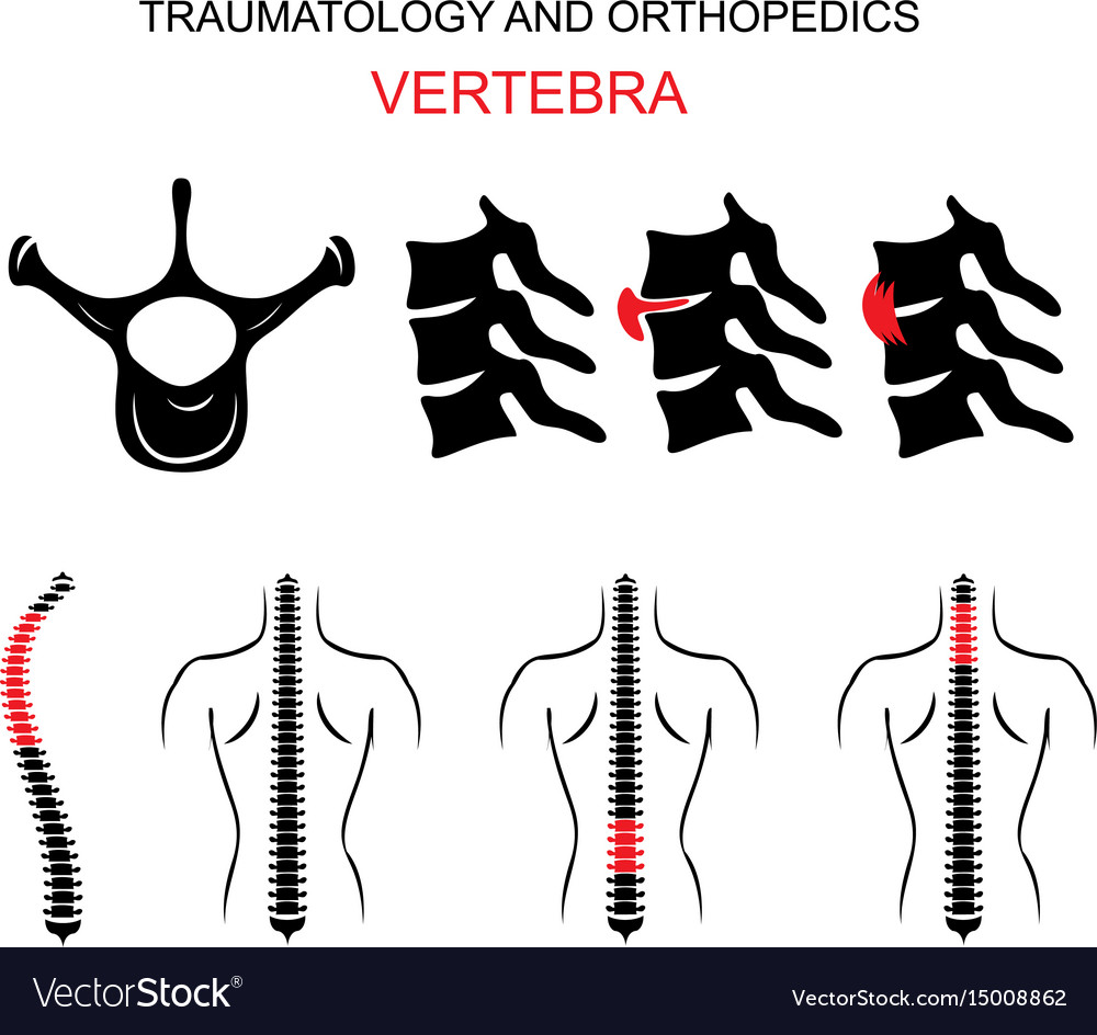 Traumatology and orthopedics the spine vertebra