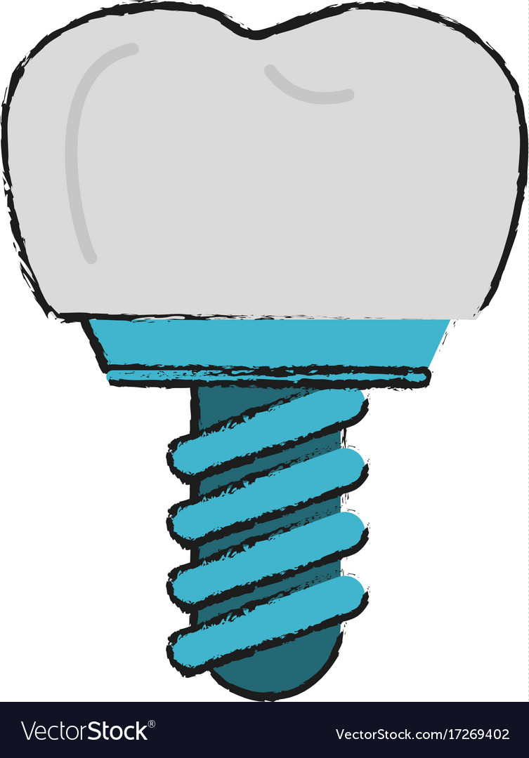 Tooth implant odontology