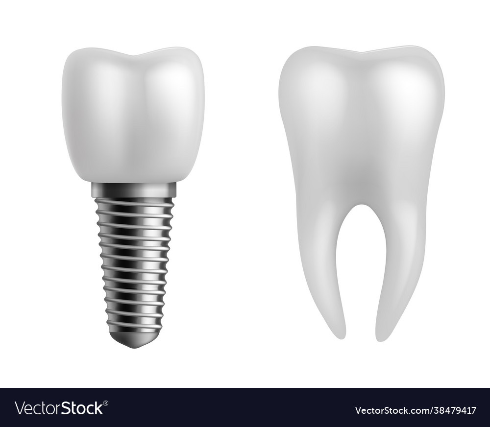 Dental implant and teeth realistic orthodontic Vector Image