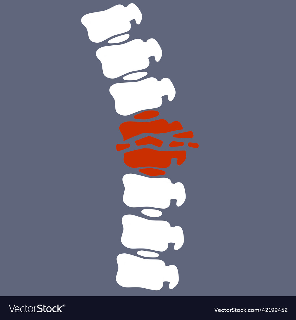 Problems with spine posture issues vector image Problems with spine posture issues