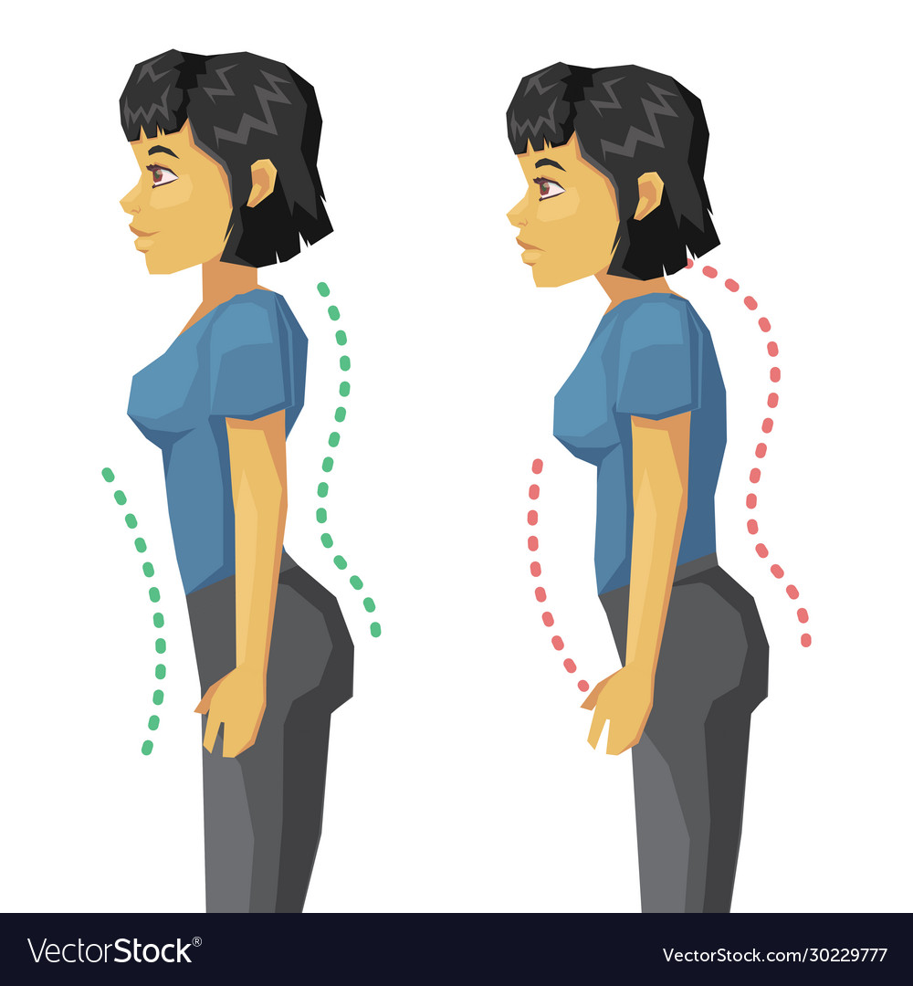 Incorrect standing posture make people have bad Vector Image