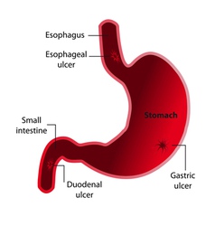 Endoscopy Royalty Free Vector Image - VectorStock