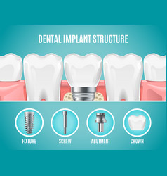 Tooth structure Royalty Free Vector Image - VectorStock