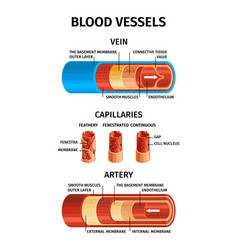 Atherosclerosis stages heart strokes thrombus Vector Image