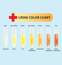 Urine color chart in test tubes medical Royalty Free Vector