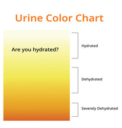 Urine color chart in test tubes medical Royalty Free Vector