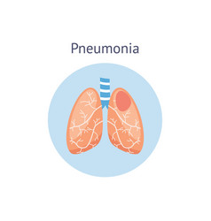 Human respiratory system diseases informative Vector Image