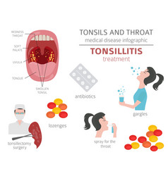 Tonsils and throat diseases peritonsillar abscess Vector Image