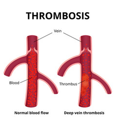 Blood & Vessels Vector Images (over 1,200)