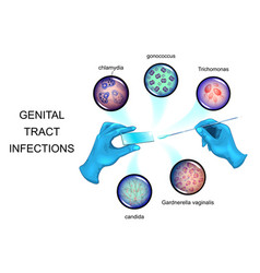 gonorrhea transmitted sexually causative