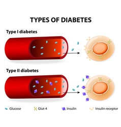 Types 2 diabetes mellitus comparison cell Vector Image