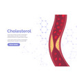 cholesterol artery thrombosis micro vascular vector image vector image