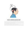 hair transplantation vector image