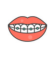 mouth and teeth smile with braces dental related vector image