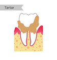 isolated tooth vector image vector image