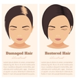 hair loss in women vector image