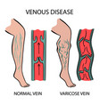 Human veins and arteries Royalty Free Vector Image