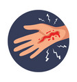 hand injury icon vector image vector image